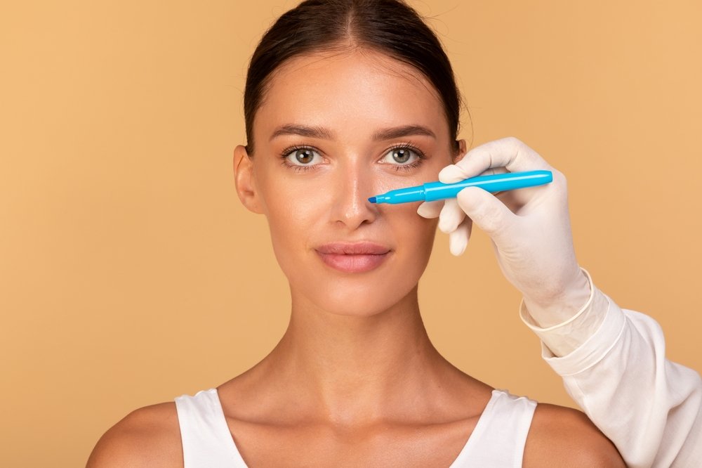 Rinoplastia e uso de óculos