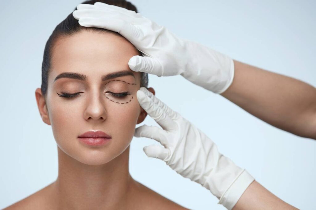Blefaroplastia