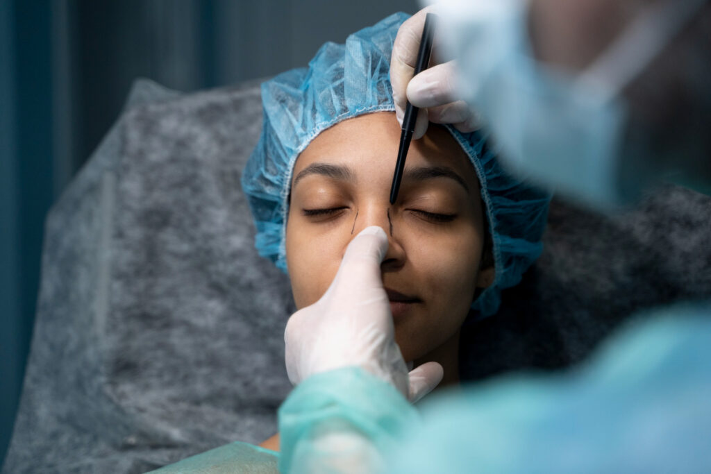 Rinoplastia