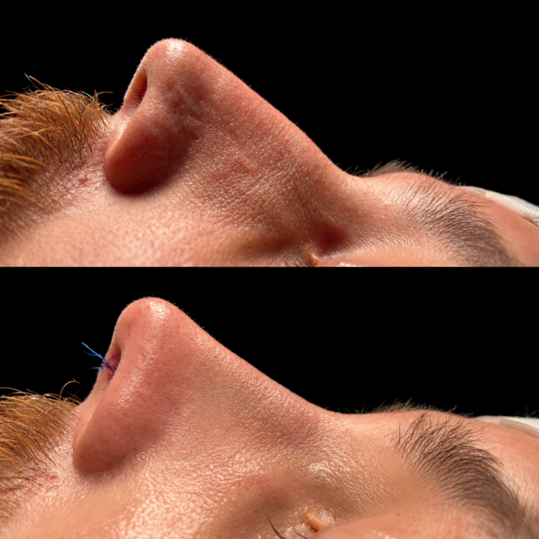 Antes x depois 4